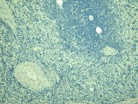 EB05419 3