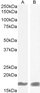 Goat Anti-AIF1/IBA1 isoform 1 and 3 Antibody