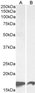 Goat Anti-AIF1/IBA1 isoform 1 and 3 Antibody