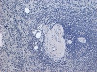 EB05419 3