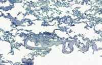 EB05419 5