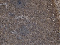 EB05419 2