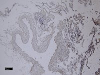 EB07174 6
