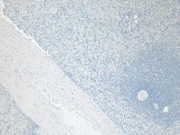 EB07174 5