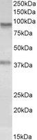 EB09865 1