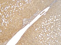 EB12281 2