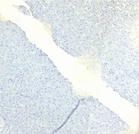 EB06795 4