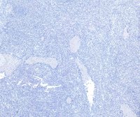 EB06795 6