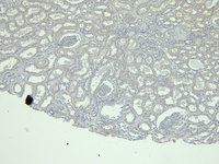 EB11759 4