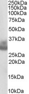 EB06733 1