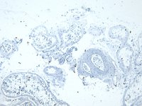 EB05622 2