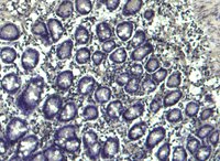 EB05738 4