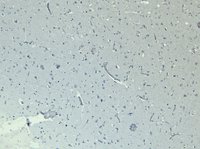 EB09984 3