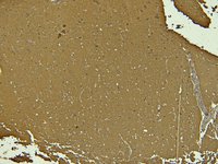 EB07258 2