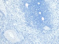EB06394 2