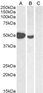 Goat Anti-FOXP3 / SCURFIN Antibody