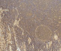 EB11755 2