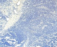 EB11755 3