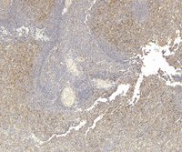 EB08987 2