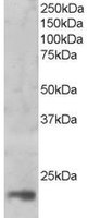 EB05504 1