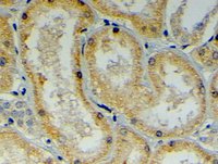EB06289 1