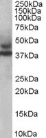 EB05883 1