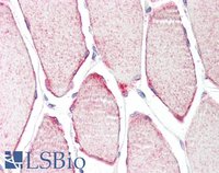 EB05883 2
