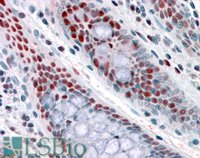 EB07698 1