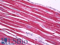 EB10188 4
