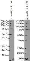 EB10188 1