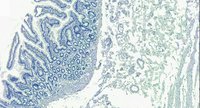 EB11413 3