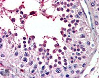 EB07176 1