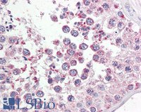 EB09551 1