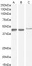 Goat Anti-Smooth muscle alpha-actin Antibody