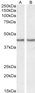 Goat Anti-Smooth muscle alpha-actin Antibody