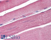 EB07042 1