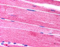 EB05455 1