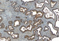 EB09209 1