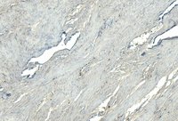 EB09209 2