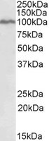 EB11393 1