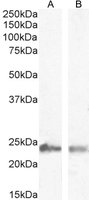 EB06281-T 1
