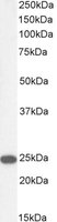 EB06281-T 2