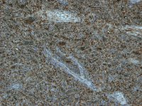 EB09441 2