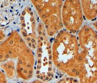 EB05908 1
