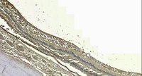 EB07599 1