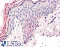 EB05745 2